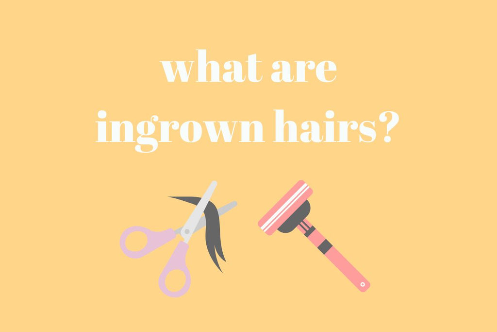 What Are Ingrown Hairs?