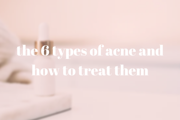 The 6 Types of Acne and how to Treat Them